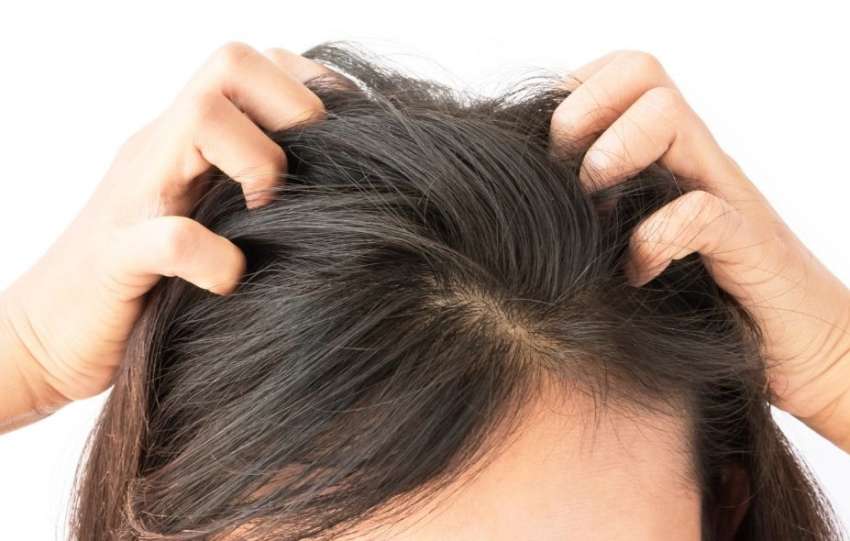 Why the Health of Your Scalp Is Important