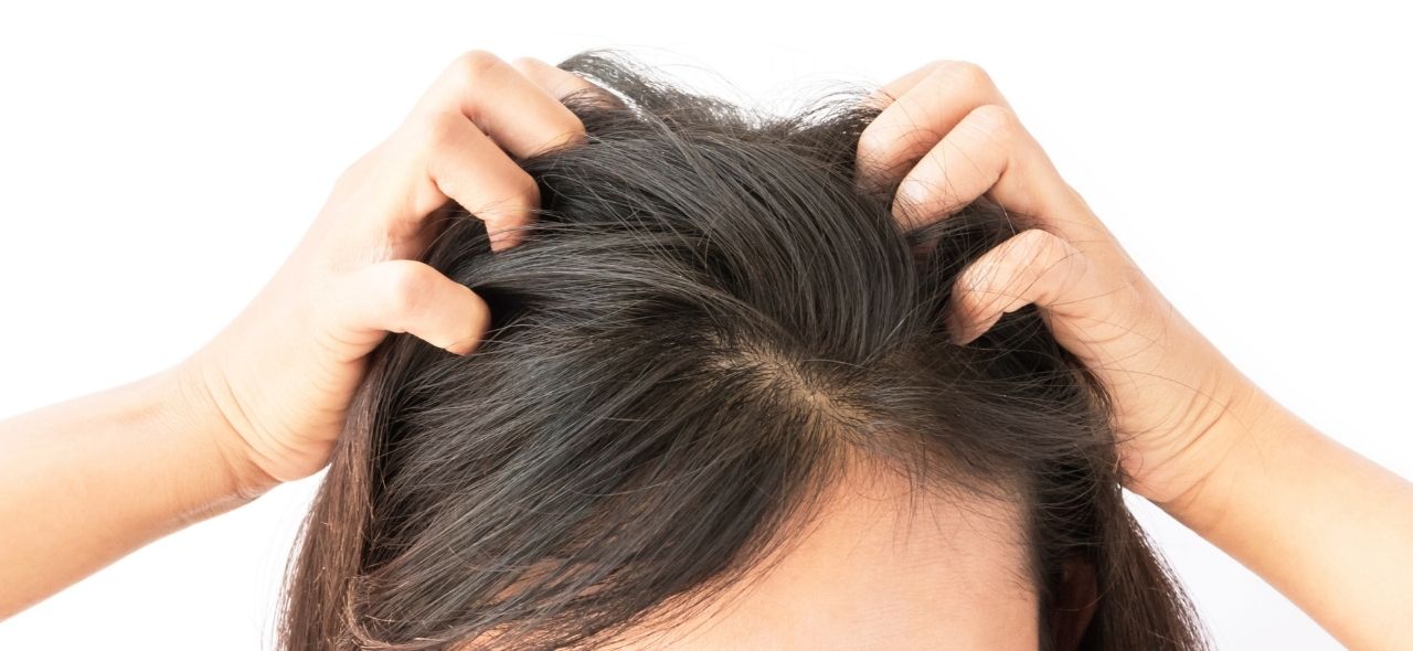 Why the Health of Your Scalp Is Important